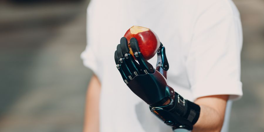 Bionic Prosthetics